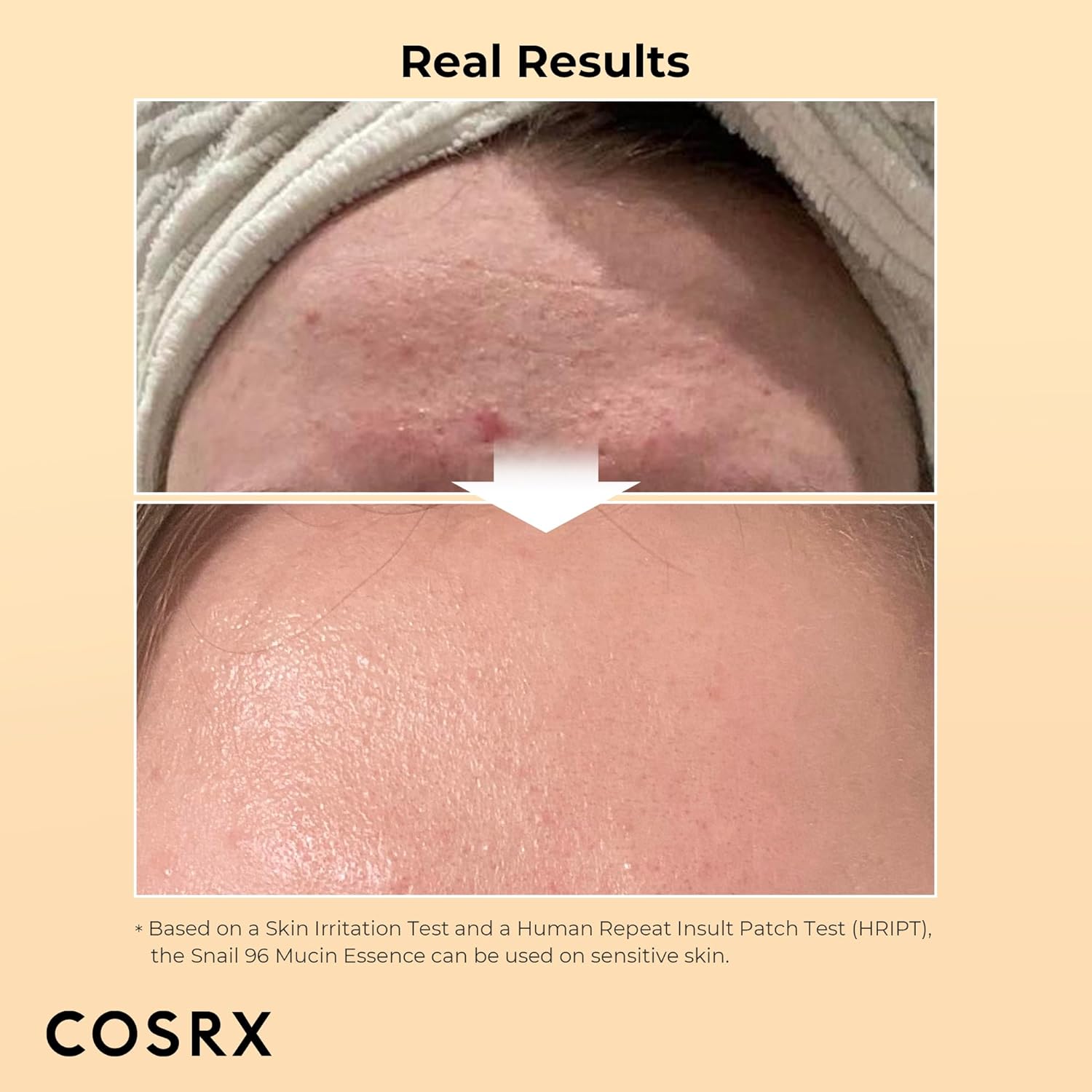 COSRX Advanced Snail 96 Mucin Power Essence – Repairing Serum 100ml
