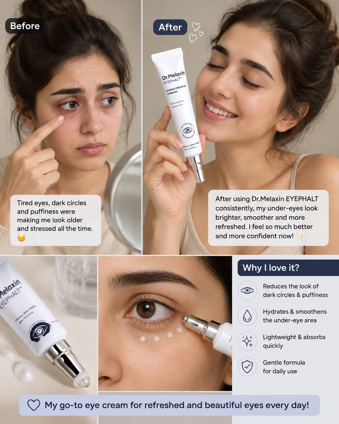 Dr.Melaxin EYEPhALT™ Eyebag Cream – Niacinamide 5% + Adenosine 2% - MasterHub store